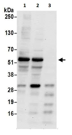 Western blot - Anti-LAP2 antibody (AB226348)