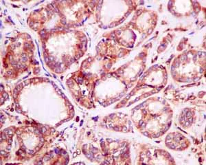 Immunohistochemistry (Formalin/PFA-fixed paraffin-embedded sections) - Anti-LAP3 antibody [EPR10330] (AB154809)