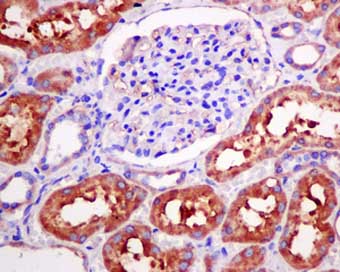 Immunohistochemistry (Formalin/PFA-fixed paraffin-embedded sections) - Anti-LAP3 antibody [EPR10330] (AB154809), expandable thumbnail