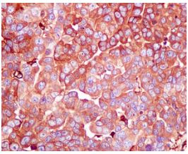 Immunohistochemistry (Formalin/PFA-fixed paraffin-embedded sections) - Anti-LAP3 antibody [EPR10330] - BSA and Azide free (AB249116), expandable thumbnail