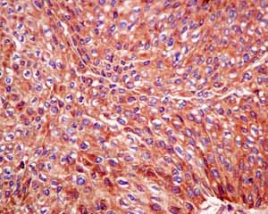 Immunohistochemistry (Formalin/PFA-fixed paraffin-embedded sections) - Anti-LAP3 antibody [EPR10330] - BSA and Azide free (ab249116), expandable thumbnail