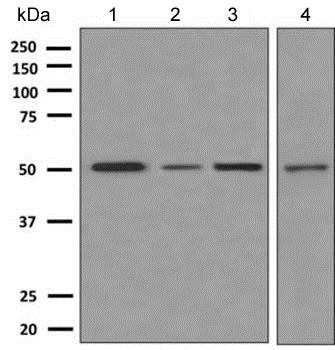 Western blot - Anti-LAP3 antibody [EPR10330] - BSA and Azide free (AB249116), expandable thumbnail