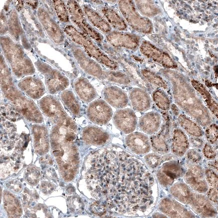 Immunohistochemistry (Formalin/PFA-fixed paraffin-embedded sections) - Anti-LAPTM4B antibody [CL5289] (AB242376)