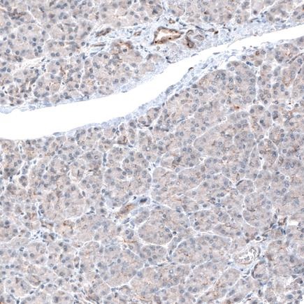 Immunohistochemistry (Formalin/PFA-fixed paraffin-embedded sections) - Anti-LAPTM4B antibody [CL5289] (ab242376), expandable thumbnail