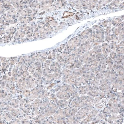 Immunohistochemistry (Formalin/PFA-fixed paraffin-embedded sections) - Anti-LAPTM4B antibody [CL5289] (AB242376)