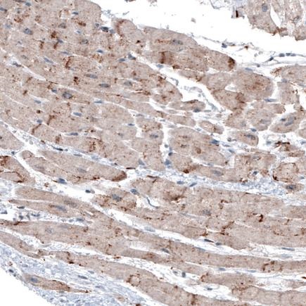Immunohistochemistry (Formalin/PFA-fixed paraffin-embedded sections) - Anti-LAPTM4B antibody [CL5289] (AB242376), expandable thumbnail