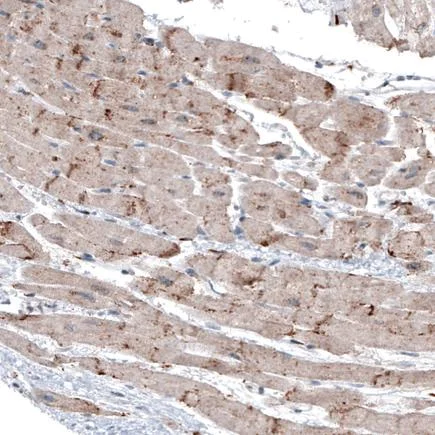 Immunohistochemistry (Formalin/PFA-fixed paraffin-embedded sections) - Anti-LAPTM4B antibody [CL5289] (AB242376)