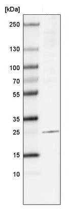 Western blot - Anti-LAPTM4B antibody [CL5289] (AB242376), expandable thumbnail