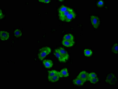 Immunocytochemistry/ Immunofluorescence - Anti-LAR antibody (AB238600)