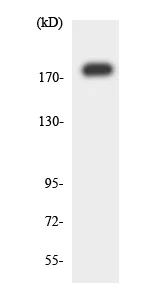 Western blot - Anti-LARG antibody (AB136072)