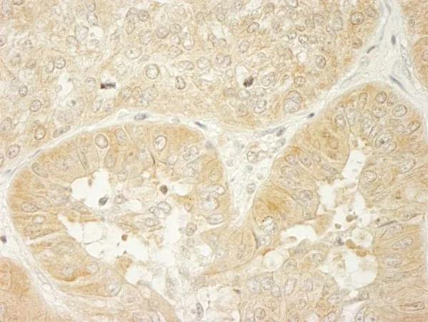 Immunohistochemistry (Formalin/PFA-fixed paraffin-embedded sections) - Anti-LARP1 antibody (AB245635)