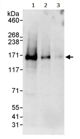 Western blot - Anti-LARP1 antibody (AB245635)