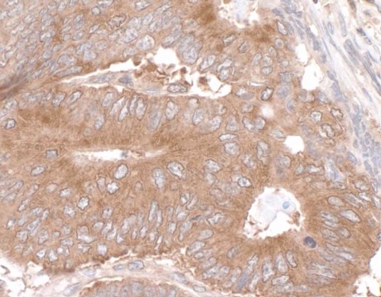 Immunohistochemistry (Formalin/PFA-fixed paraffin-embedded sections) - Anti-LARP1 antibody (AB86359), expandable thumbnail