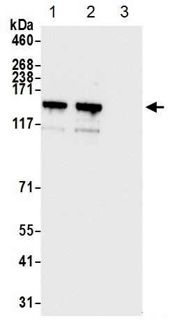 Immunoprecipitation - Anti-LARP1 antibody (AB86359), expandable thumbnail