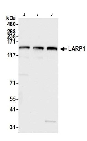 Western blot - Anti-LARP1 antibody (AB86359), expandable thumbnail