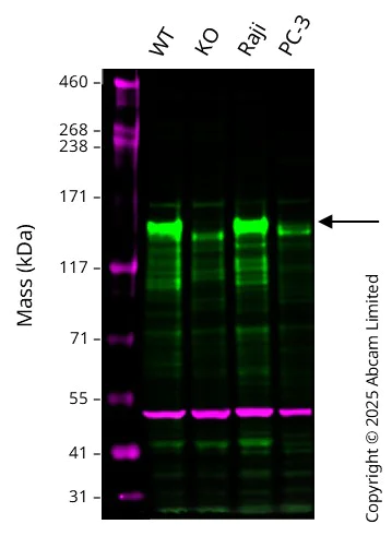 Western blot - Anti-LARP1 antibody (AB86359)