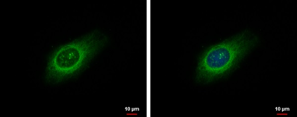 Immunocytochemistry/ Immunofluorescence - Anti-LARP1 antibody - C-terminal (AB229142), expandable thumbnail