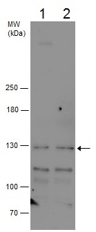 Western blot - Anti-LARP1 antibody - C-terminal (AB229142), expandable thumbnail