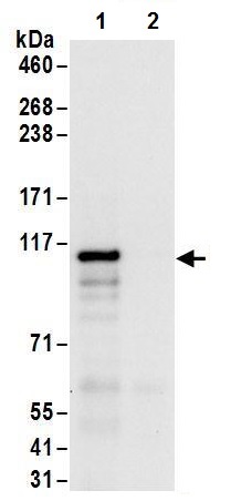 Immunoprecipitation - Anti-LARP4 antibody (AB241489)