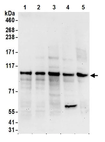 Western blot - Anti-LARP4 antibody (AB241489)