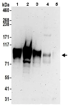 Western blot - Anti-LARP4B antibody (AB197085)