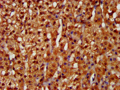 Immunohistochemistry (Formalin/PFA-fixed paraffin-embedded sections) - Anti-LARP6 antibody (AB238763)