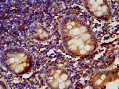 Immunohistochemistry (Formalin/PFA-fixed paraffin-embedded sections) - Anti-LARP6 antibody (AB238763)