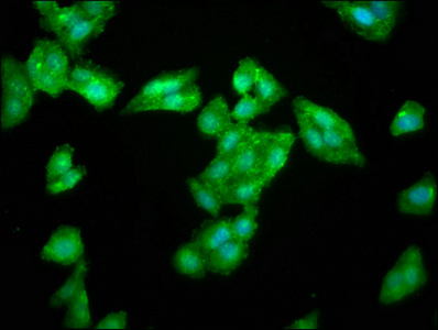 Immunocytochemistry/ Immunofluorescence - Anti-LAS1L antibody (AB236954)
