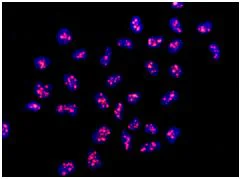 Immunocytochemistry/ Immunofluorescence - Anti-LAS1L antibody [EPR8988(B)] - BSA and Azide free (AB248934)