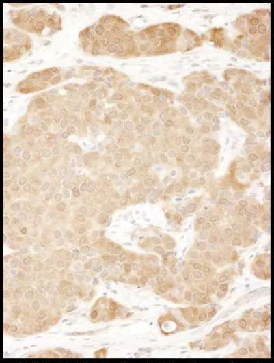 Immunohistochemistry (Formalin/PFA-fixed paraffin-embedded sections) - Anti-LASP1 antibody (AB117806)