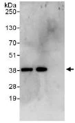 Immunoprecipitation - Anti-LASP1 antibody (AB117806)