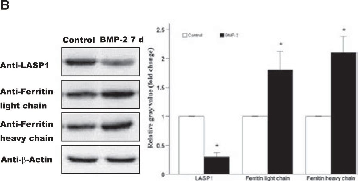 Western blot - Anti-LASP1 antibody (AB117806)