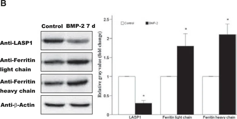 Western blot - Anti-LASP1 antibody (AB117806)