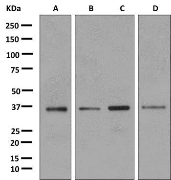 Western blot - Anti-LASP1 antibody [EPR11221] - BSA and Azide free (AB249285)