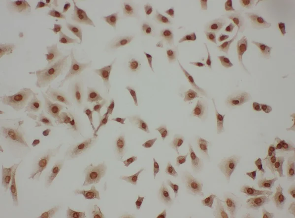 Immunocytochemistry - Anti-LASP1 antibody - N-terminal (AB191022)