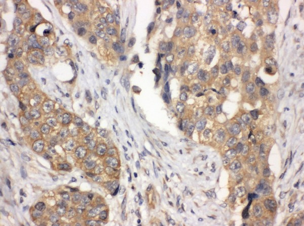 Immunohistochemistry (Formalin/PFA-fixed paraffin-embedded sections) - Anti-LASP1 antibody - N-terminal (AB191022)