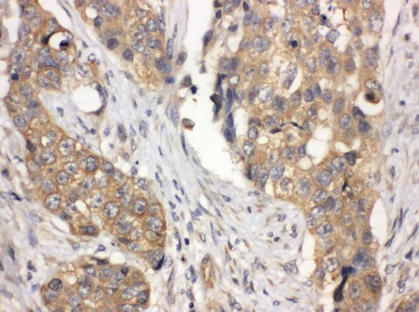 Immunohistochemistry (Formalin/PFA-fixed paraffin-embedded sections) - Anti-LASP1 antibody - N-terminal (AB191022)