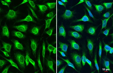Immunocytochemistry/ Immunofluorescence - Anti-LASS2 antibody [HL1717] (AB308189)