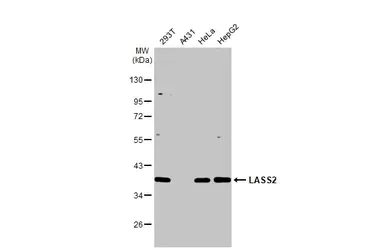 Western blot - Anti-LASS2 antibody [HL1717] (AB308189)