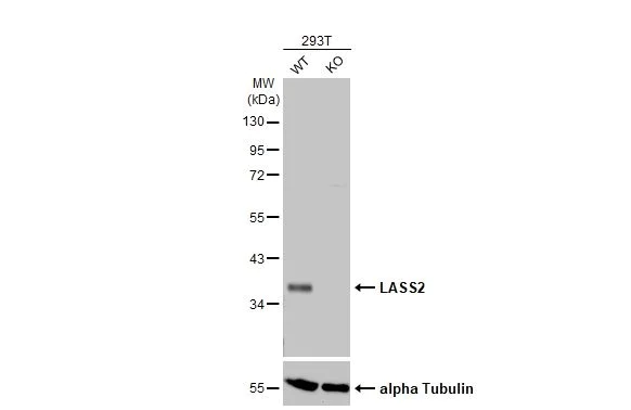 Western blot - Anti-LASS2 antibody [HL1717] (AB308189)