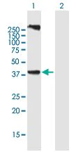 Western blot - Anti-LASS3 antibody (AB169259)