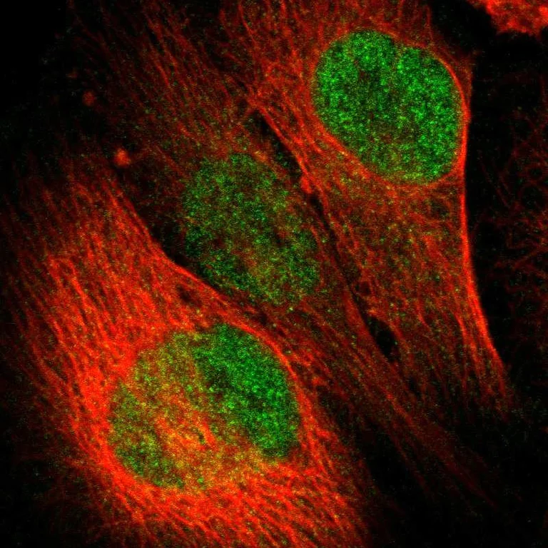 Immunocytochemistry/ Immunofluorescence - Anti-LASS3 antibody (AB272552)