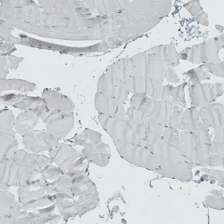 Immunohistochemistry (Formalin/PFA-fixed paraffin-embedded sections) - Anti-LASS3 antibody (AB272552)