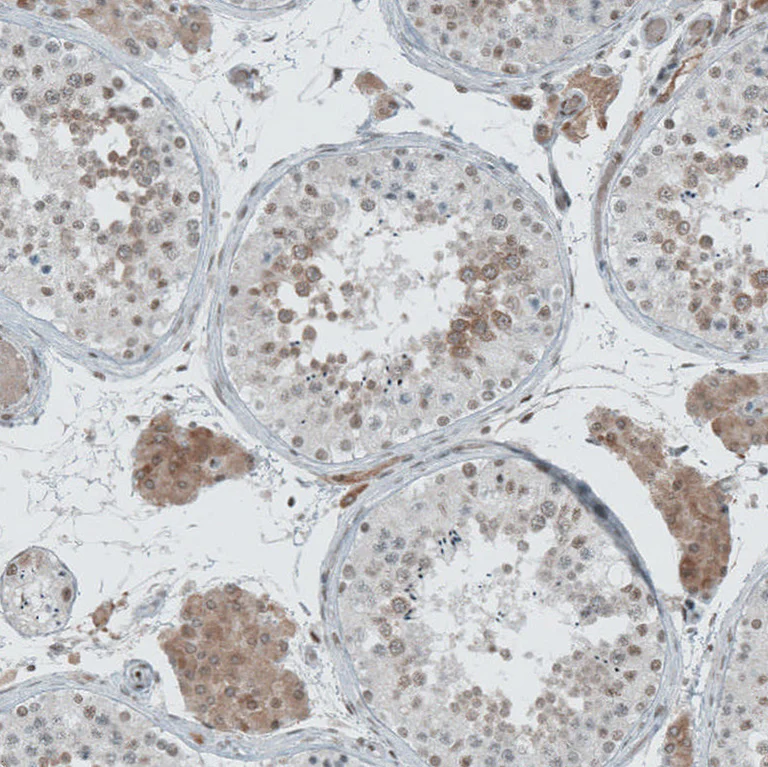 Immunohistochemistry (Formalin/PFA-fixed paraffin-embedded sections) - Anti-LASS3 antibody (AB272552)