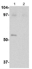 Western blot - Anti-Lass5 antibody (AB115314)