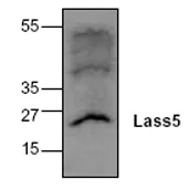 Western blot - Anti-Lass5 antibody (AB63927)