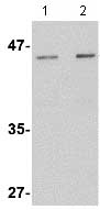 Western blot - Anti-Lass5 antibody (AB73289)