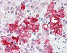 Immunohistochemistry (Formalin/PFA-fixed paraffin-embedded sections) - Anti-LASS6/CERS6 antibody (AB115539)