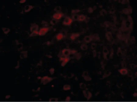 Immunohistochemistry (Formalin/PFA-fixed paraffin-embedded sections) - Anti-LASS6/CERS6 antibody (AB115539)