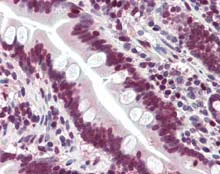 Immunohistochemistry (Formalin/PFA-fixed paraffin-embedded sections) - Anti-LASS6/CERS6 antibody (AB115539)